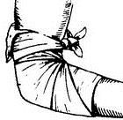 Косыночная повязка на область локтевого сустава