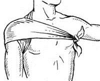 Косыночная повязка на плечевой сустав