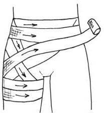 Передняя колосовидная повязка области тазобедренного сустава