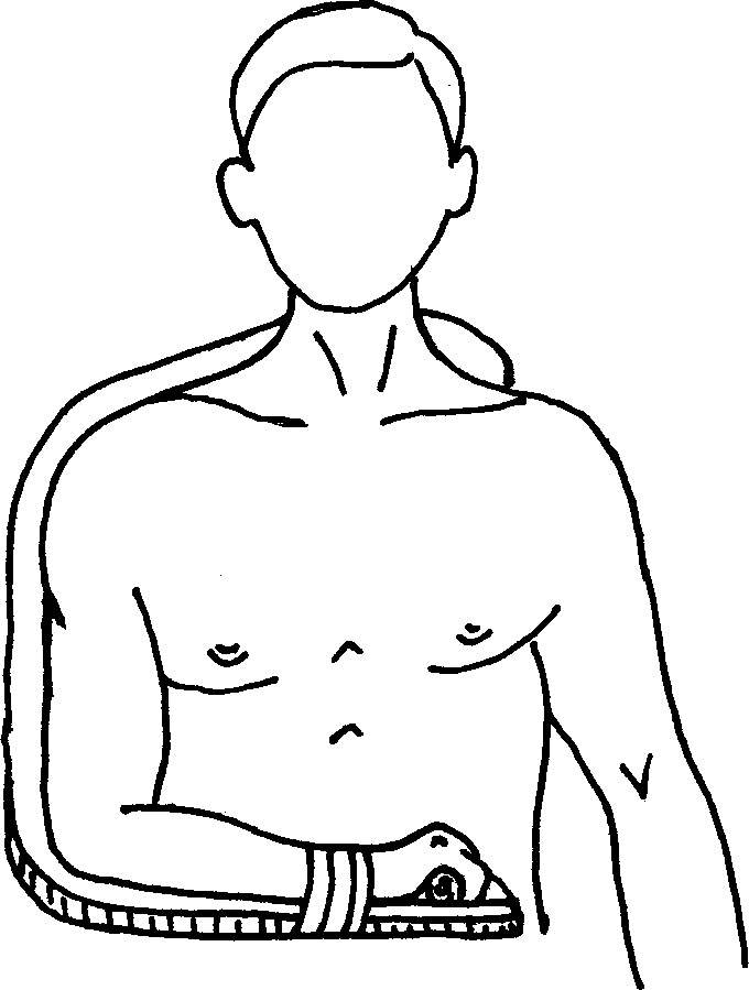 Фиксация поврежденного плечевого пояса при помощи шины Крамера