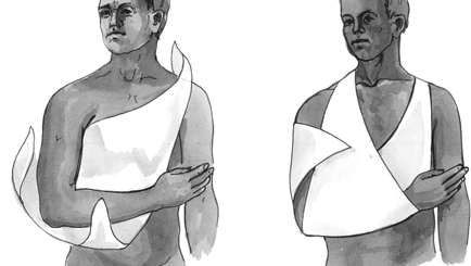 Использование косынки для иммобилизации плечевого пояса и верхней конечности