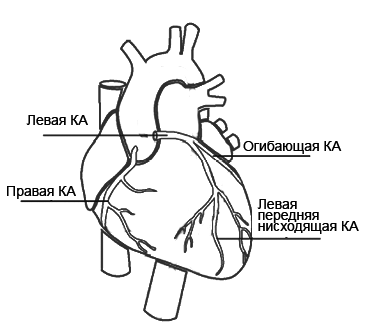 Расположение коронарных артерий сердца
