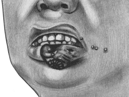 Первичная сифилома на красной кайме губ