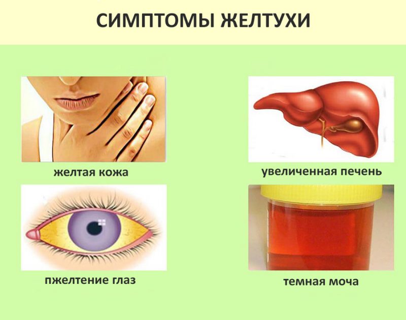 Больной желтухой на фоне холедохолитиаза нуждается